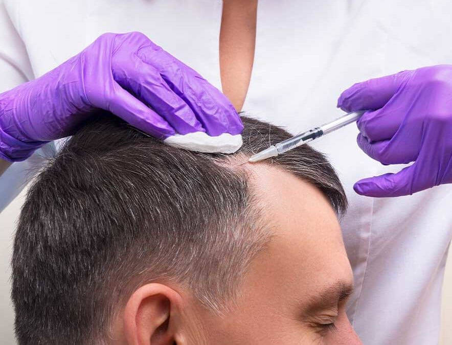 Türkiye'de saç ekimi sonrası yeni saç büyümesini hızlandırmak için plazma enjeksiyonu