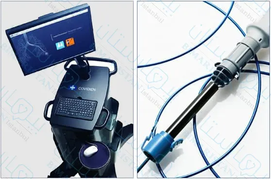 Gelişmiş elektromanyetik endoskop kullanarak bronkoskopi