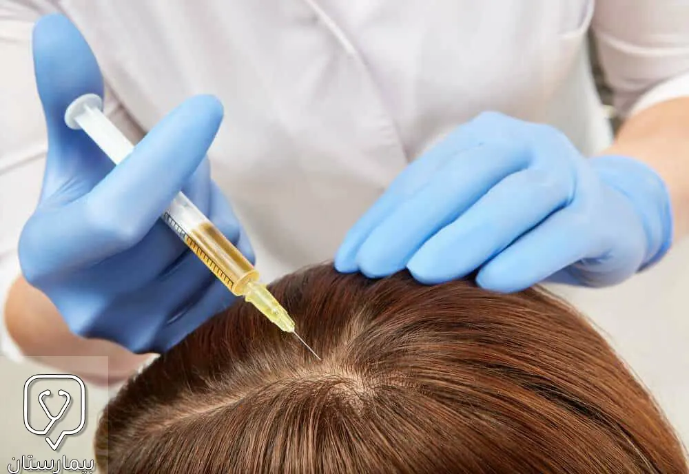 A picture showing the process of injecting the hair stem cell ampoule